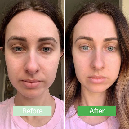 Avocado Eye Mask